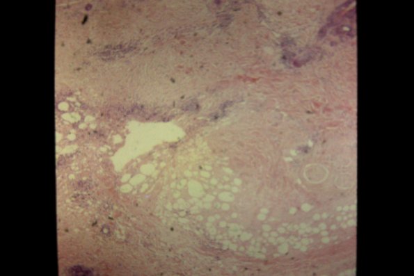 Lupus Profundus (2)