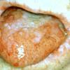 Paraneoplastic Pemphigus (4)