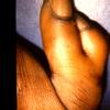 Thumb Anomalies