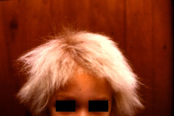 Crimped Hair (16)