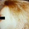 Uncombable Hair - Spunglass
