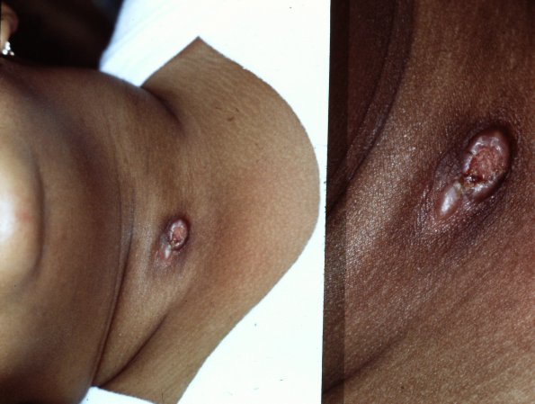 PICT0033