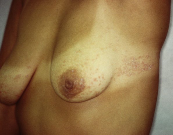 PICT0005