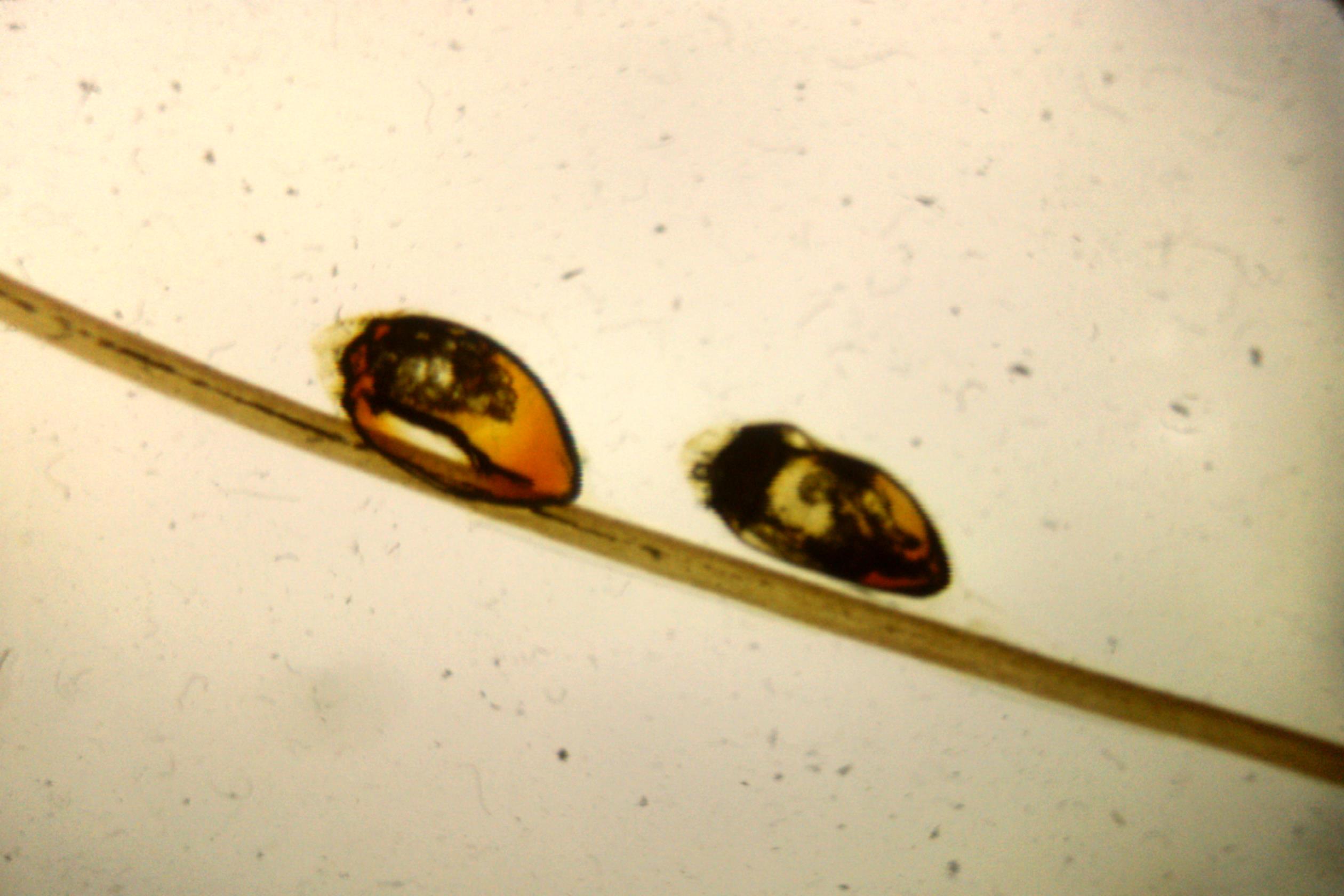 Dsp Insect Pedicularis Capritis | Insects Pedicularis Capitis | Dr. Robert J ...